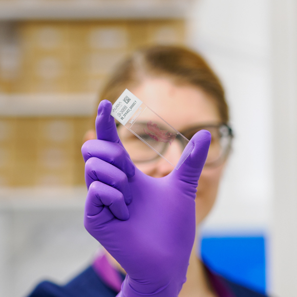 Nainen pitää edessään sormiensa välissä kudosleikelasia.