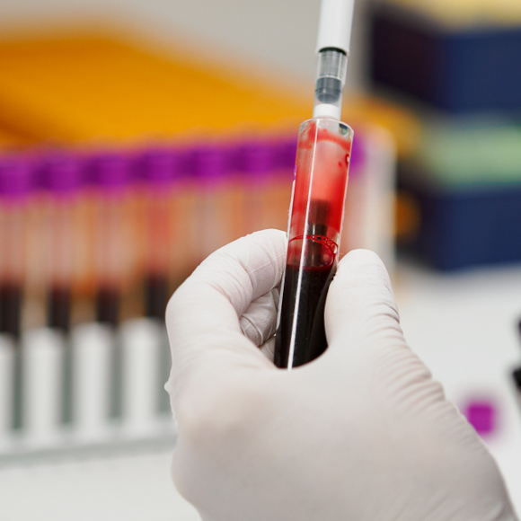 Biopankkiverinäytettä pipetoidaan.