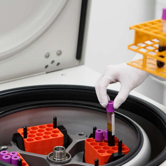 Veriputkea asetetaan sentrifuugiin.